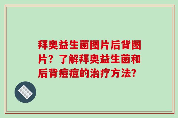 拜奥益生菌图片后背图片？了解拜奥益生菌和后背痘痘的治疗方法？
