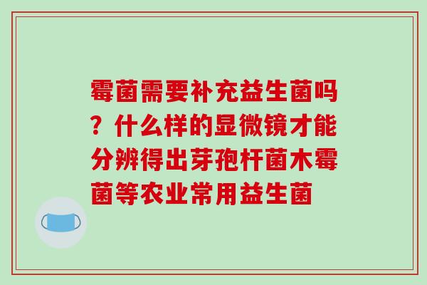 霉菌需要补充益生菌吗?什么样的显微镜才能分辨得出芽孢杆菌木霉菌等农业常用益生菌 霉菌需要补充益生菌吗?什么样的显微镜才能分辨得出芽孢杆菌木霉菌等农业常用益生菌