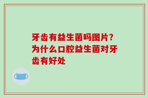 牙齿有益生菌吗图片？为什么口腔益生菌对牙齿有好处