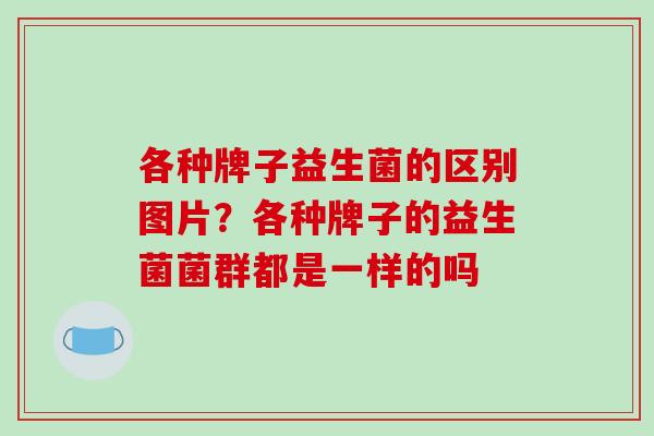 各种牌子益生菌的区别图片？各种牌子的益生菌菌群都是一样的吗