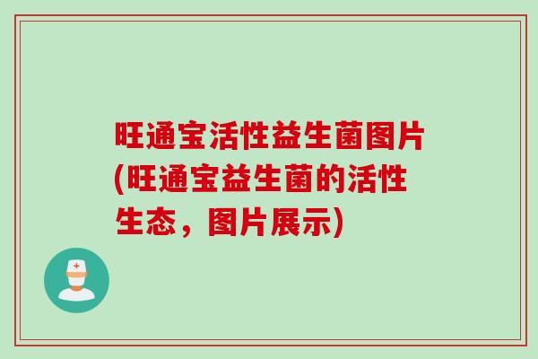 旺通宝活性益生菌图片(旺通宝益生菌的活性生态,图片展示) 旺通宝活性益生菌图片(旺通宝益生菌的活性生态,图片展示)