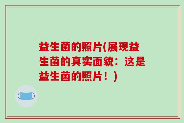 益生菌的照片(展现益生菌的真实面貌：这是益生菌的照片！)